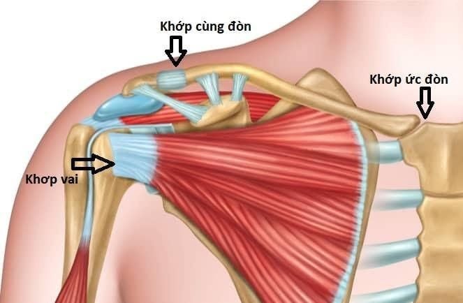Cách xử lý và điều trị trật khớp cùng đòn hiệu quả, nhanh hồi phục