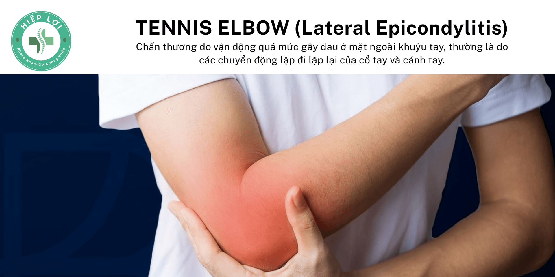Triệu chứng đau khuỷu tay Tennis Elbow lan xuống cẳng tay khi cầm nắm vật nặng, chơi thể thao